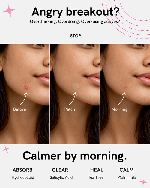 Touch Me Not- Pimple Patches